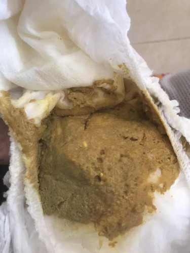 Normal atau tidk budak umur 1tahun 2bulan berak lebih 5 kali sehari
