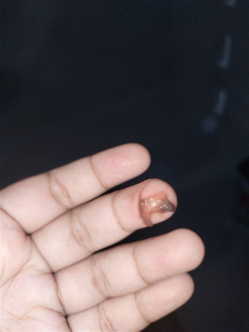 Keluar seperti gumpalan coklat,tapi tidak ada darah mengalir