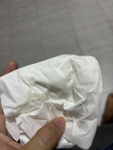มูกหรือตกขาว