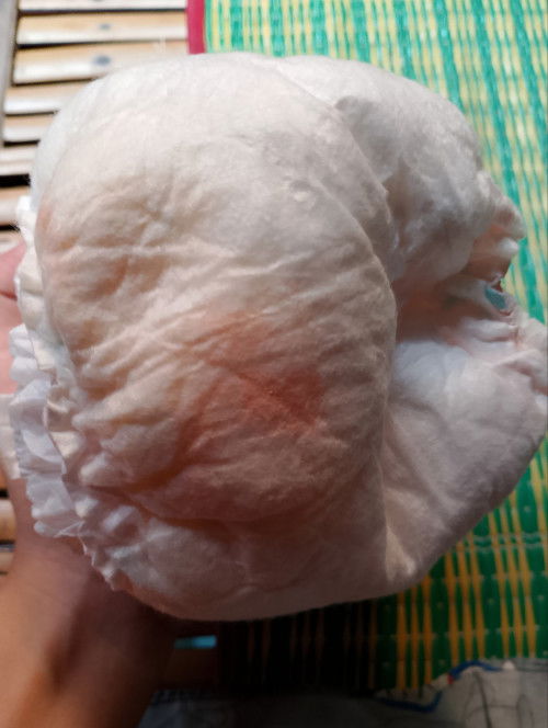 ขอคำปรึกษาแม่ๆทีค่ะ