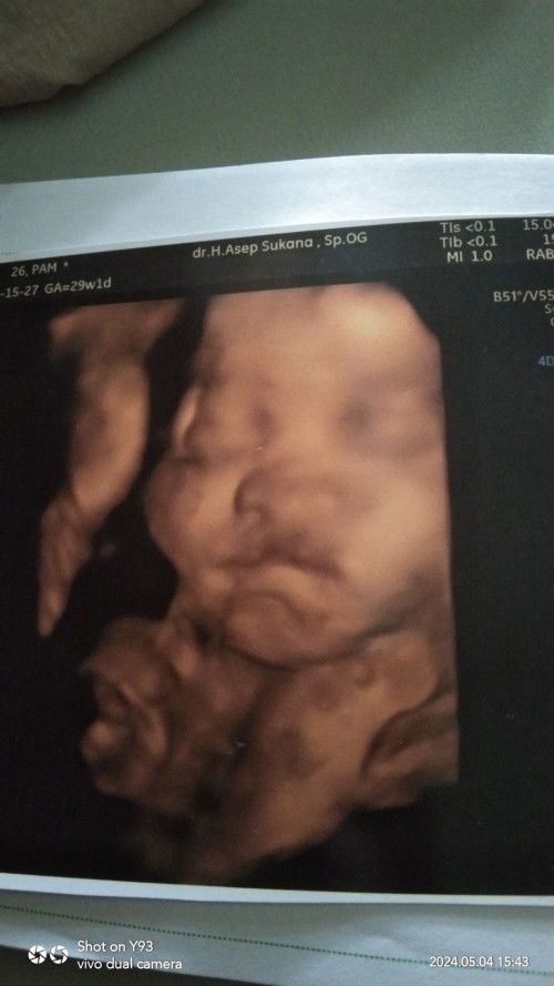 Foto usg seperti ada kelainan di bibir
