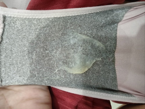 White discharge po ba ito?
