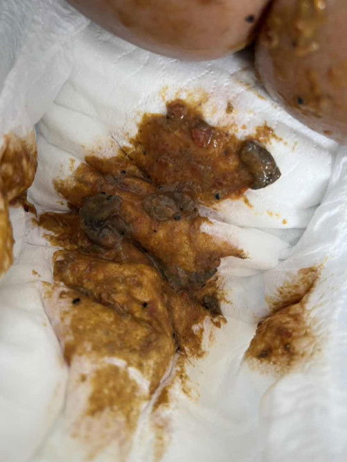 Bayi 9 bulan cirit birit + tumbuh gigi