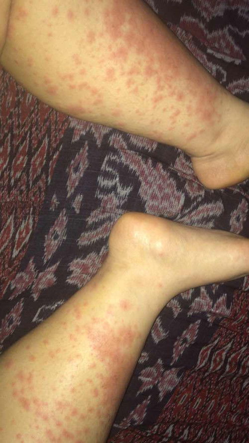 GATAL HAMIL 36 MINGGU