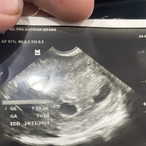 Cerita Kehamilan Pertamaku 🥀