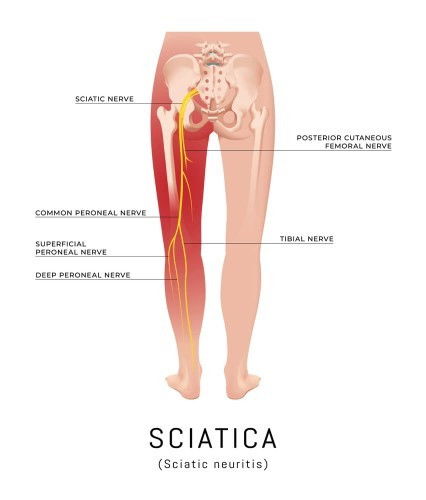 Sciatic nerve