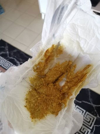 NORMAL KER UNTUK BABY 6 BULAN??