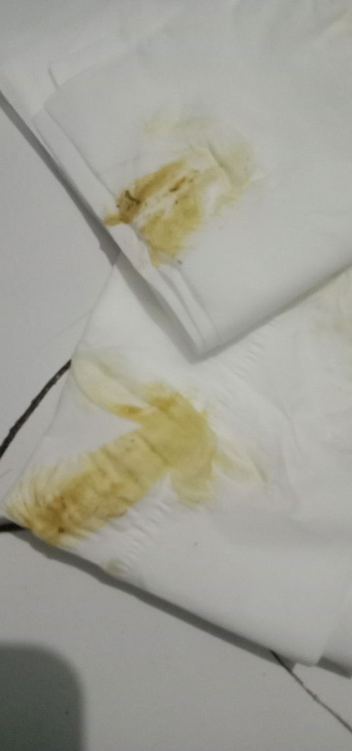 Maaf kalau jorok cuma mau tanya ini kira² flek apa keputihan ya