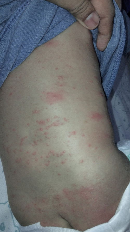 Bunda tau gak ini penyebabnya apa dn cara ngatasinnya gimana??