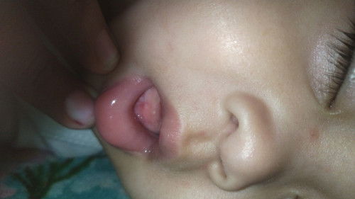 Apakah ini tanda tumbuh gigi?