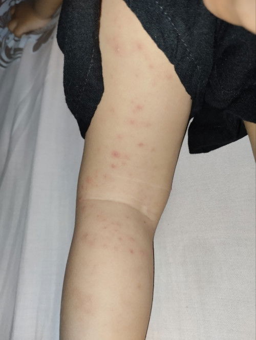 Berat badan anak sulit naik