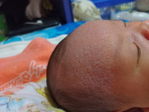 Bun mau nanya dong ada yg ngalamin kaya aku ga . Ank aku lahir tgl 29 april . Skrang dia brintisan