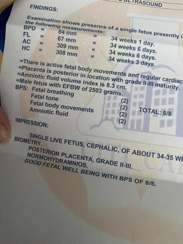 BPS ULTRASOUND Perfect score thankyou lord! 🙏😇🥰