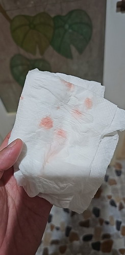 อายุครรภ์38+5