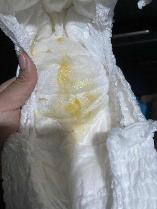 เด็ก4เดือนอึแบบนี้ปกติไหมคะ