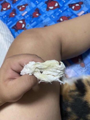 ขออภัยถ้ารูปน่าเกลียด