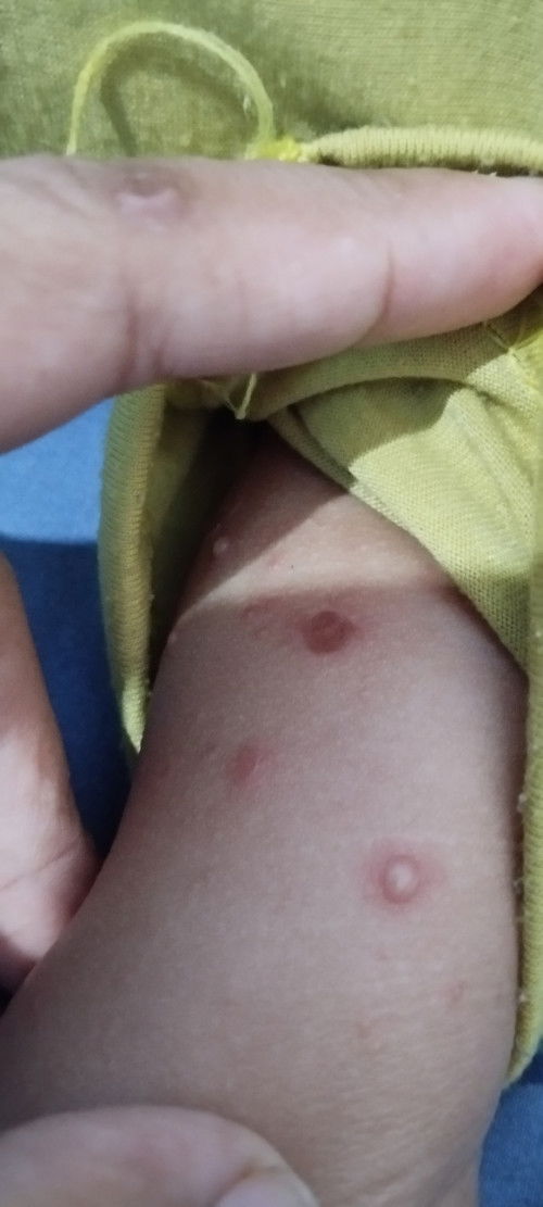 Kulit anak gatal kira2 kenapa ya