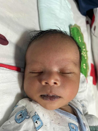 Bibir jadi hitam dan kering