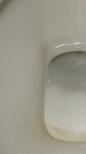 Keputihan 35 minggu