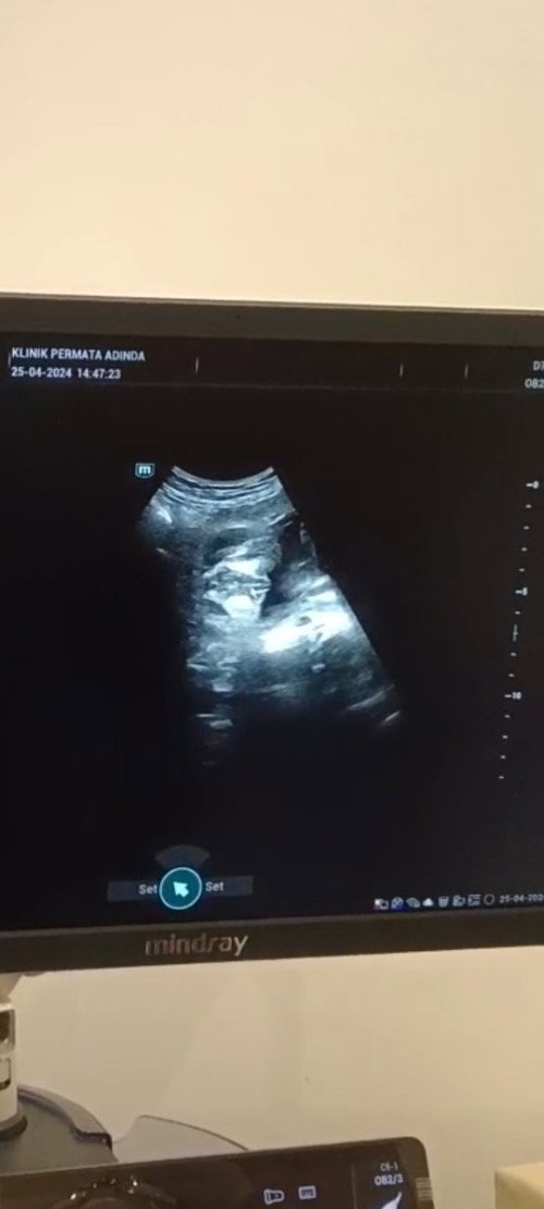 Ada yg tau gak ini Cewe atau cowo ?