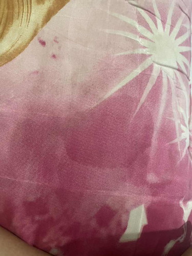 สอบถามทีค่ะ แบบนี้ควรไปโรงบาลไหมไหมค่ะ