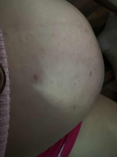 แม่ครรภ์ 32w 5D