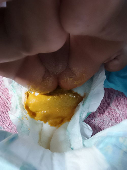 Basa ang tae ni baby