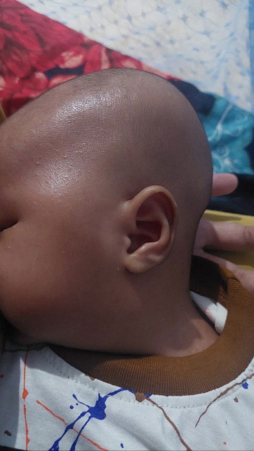 Kepala bayi 1 bulan 18 hari