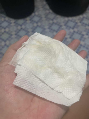 สอบถามทีค่ะ แบบนี้คืออะไร ลูกคนแรก😂ไม่ค่อยรู้อะไรเลยค่ะ