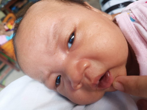 แม่ท่านไหนเคยมีลูกเป็นแบบนี้บ้าง