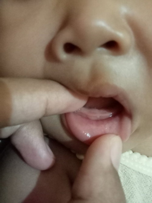 Ciri ciri tumbuh gigi.