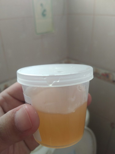 ปวดท้องข้างขวา