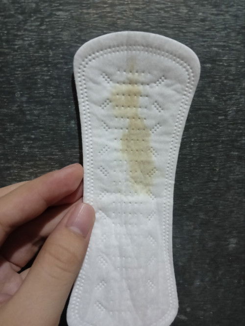 34 weeks discharge. Normal po ba?