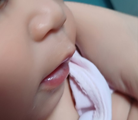Dry lips ni baby