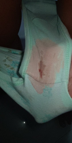 Na iE po ako kanina ng ob ko first IE may gannyan po lumitaw sakin