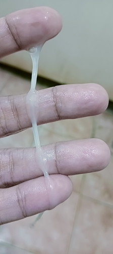 Vaginal discharge