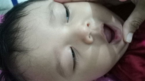 Mom.. maaf mau itu bibir bawah anak saya knp ya kok merah2 gtu? Atau sariawan ya?