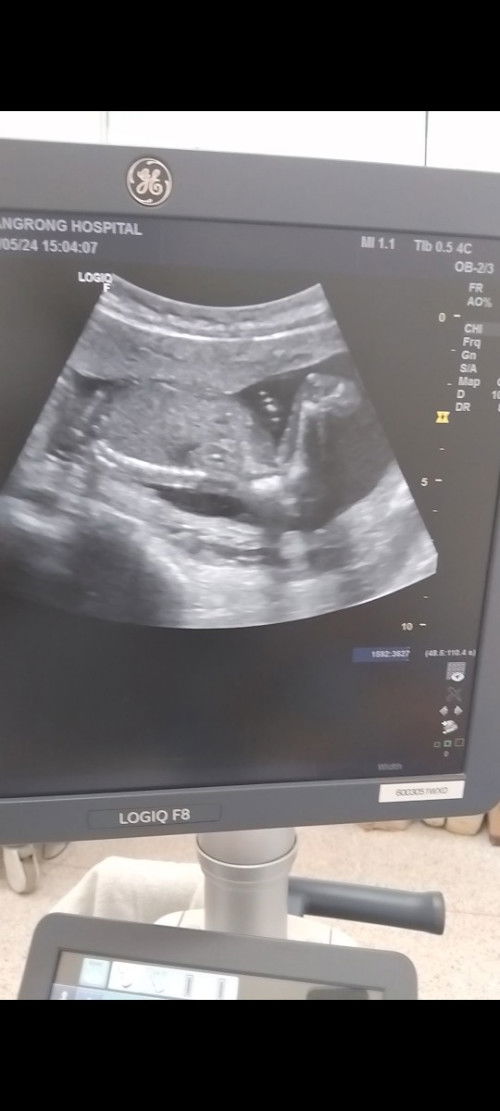 ดูเพศยังไงกันคะแม่ๆ