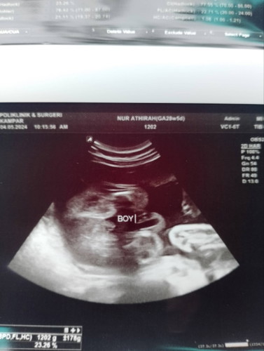 nak tanya pendapat mommies ii diluar sana