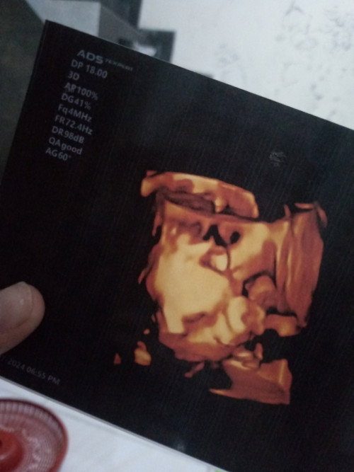 Hasil USG 4D