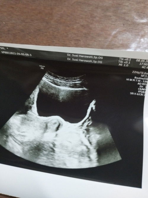 Harap harap cemas semoga beneran hamil aamiin🥲