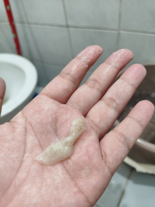 Mucus plug
