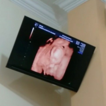 adek 19week yang doyan ngenyot jempol hihi