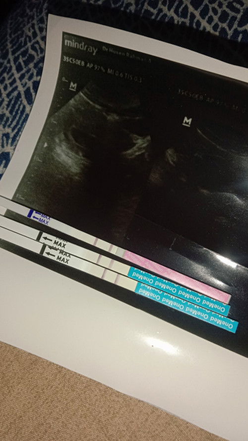 Sedikit tegang takut