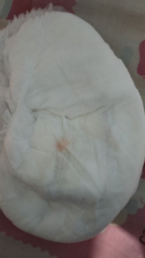 kencing sedikit dan setiap ganti popok ada bercak oren