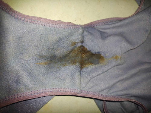 Mucus plug po ba ito?