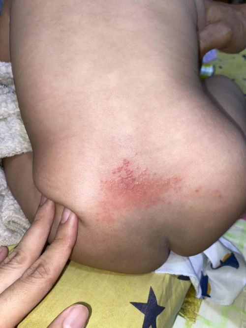 Ada babynya yg pernah ngalamin ini ?