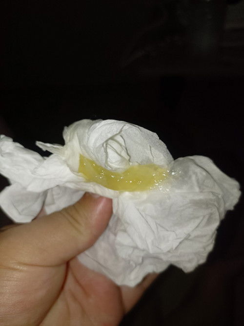 แบบนี้เรียกว่ามูกใช่มั้ยคะ