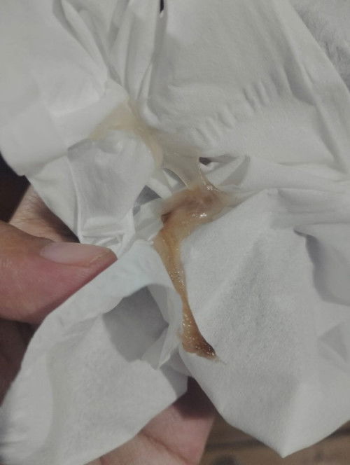 Kapan sebaiknya periksa?