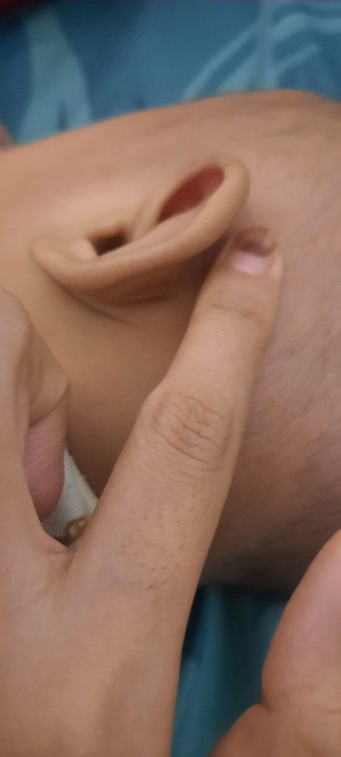 Kepala bayi tertimpa hp